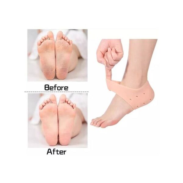 Ensemble Anti-Fissuration Du Talon En Silicone